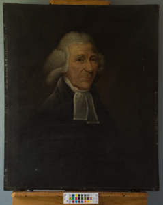 man with wig before treatment